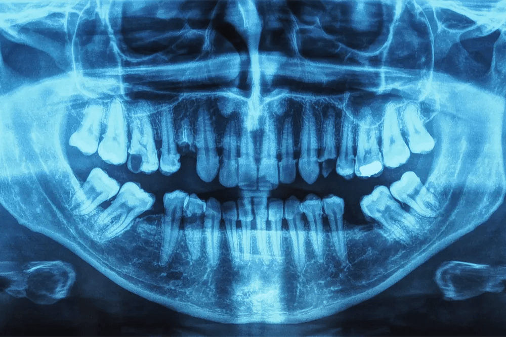 Radiation Safety California Dental Certifications