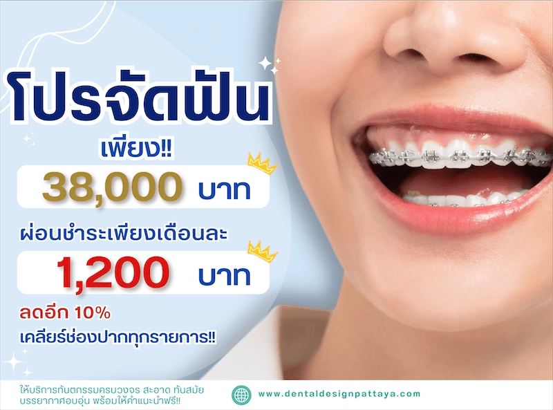 Dental Clinic & Implant Dentistry in Pattaya, Thailand DDC