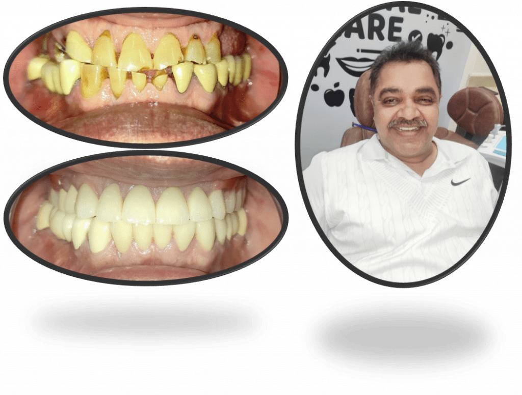 Patient Gallery Dental Designs
