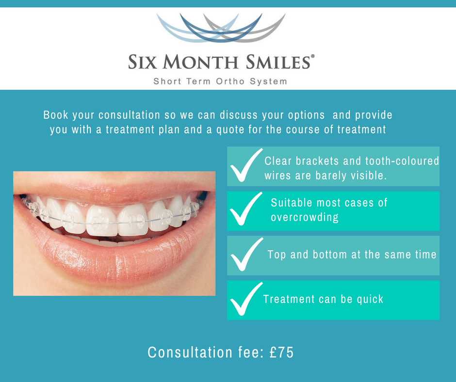 Invisible Braces Dental Elements Leatherhead, Surrey