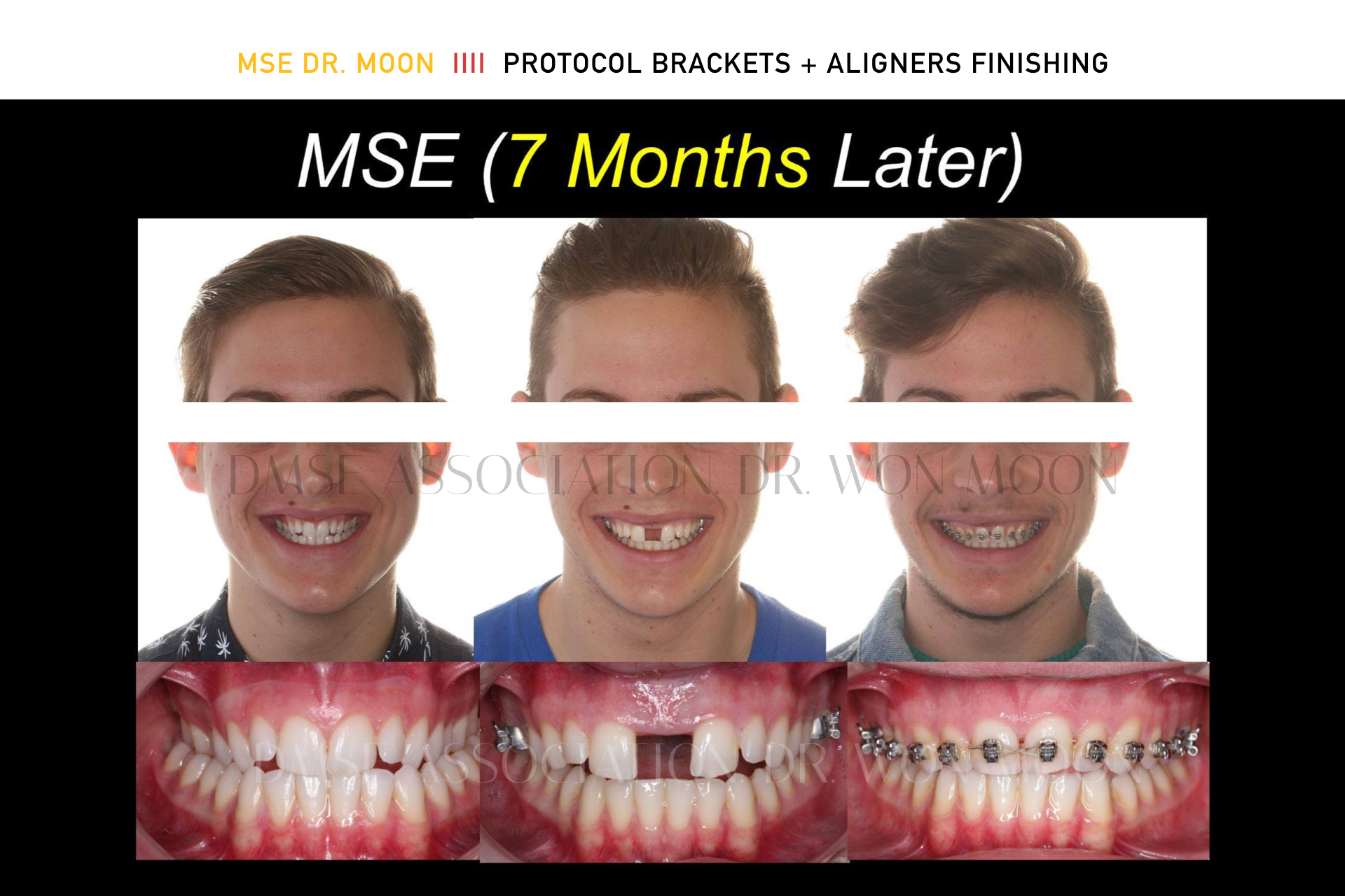 Curso de Planificación y Diseño del Digital MSE Dentalgram Academy