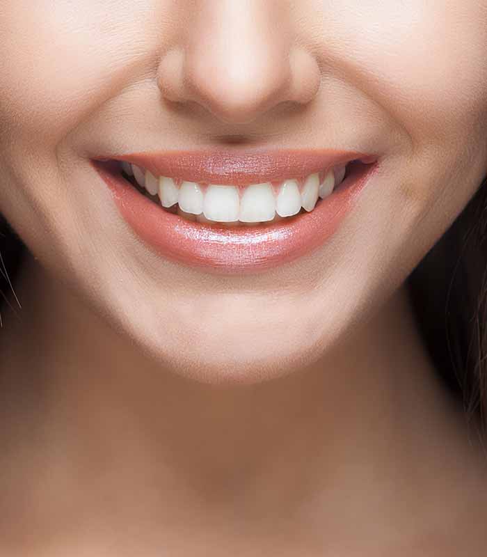 Invisible braces in Yaxley invisalign DentalHouse, Yaxley