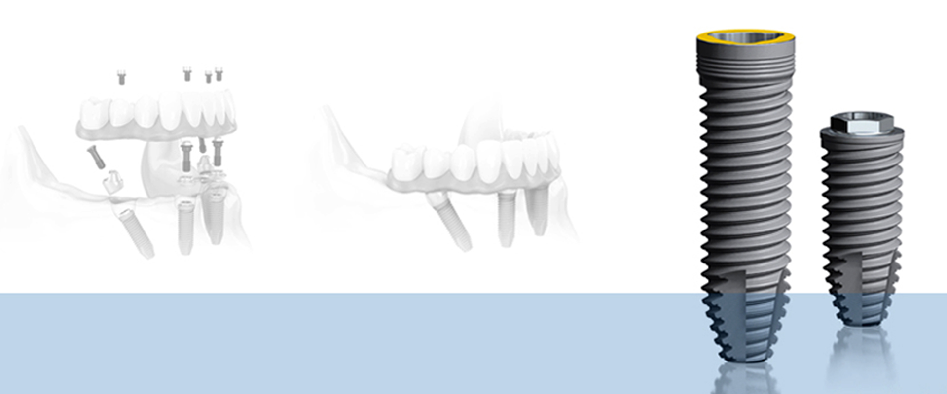 Dental Implants Dental Excellence Group