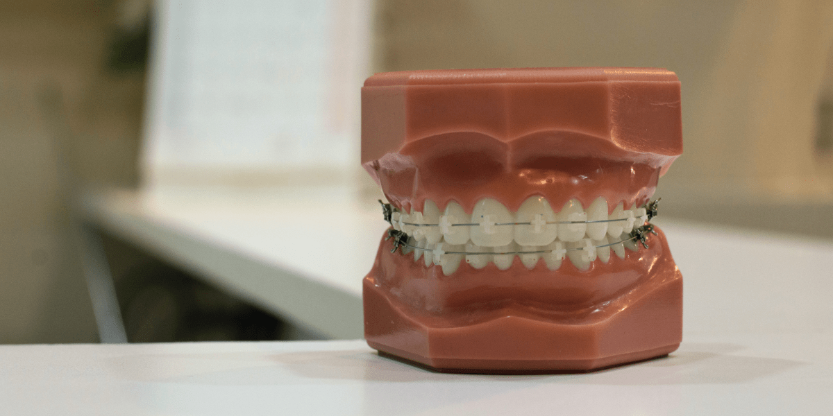 Home Dental Clinic Nairobi Dental Implants and Braces Clinic Nairobi