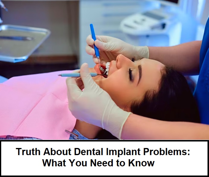 Uncovering the Truth About Dental Implant Problems What You Need to