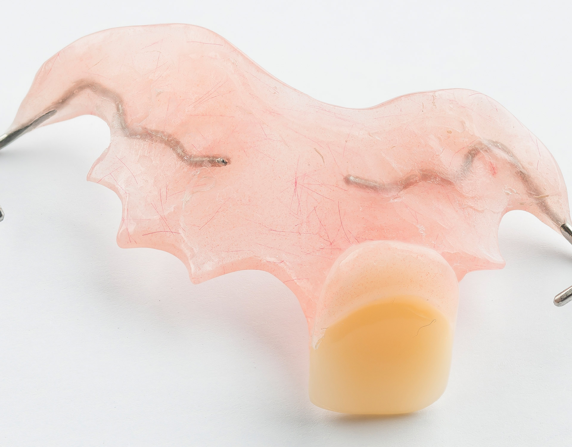 Shop For Acrylic Partial Denture Flipper Dental Lab Direct