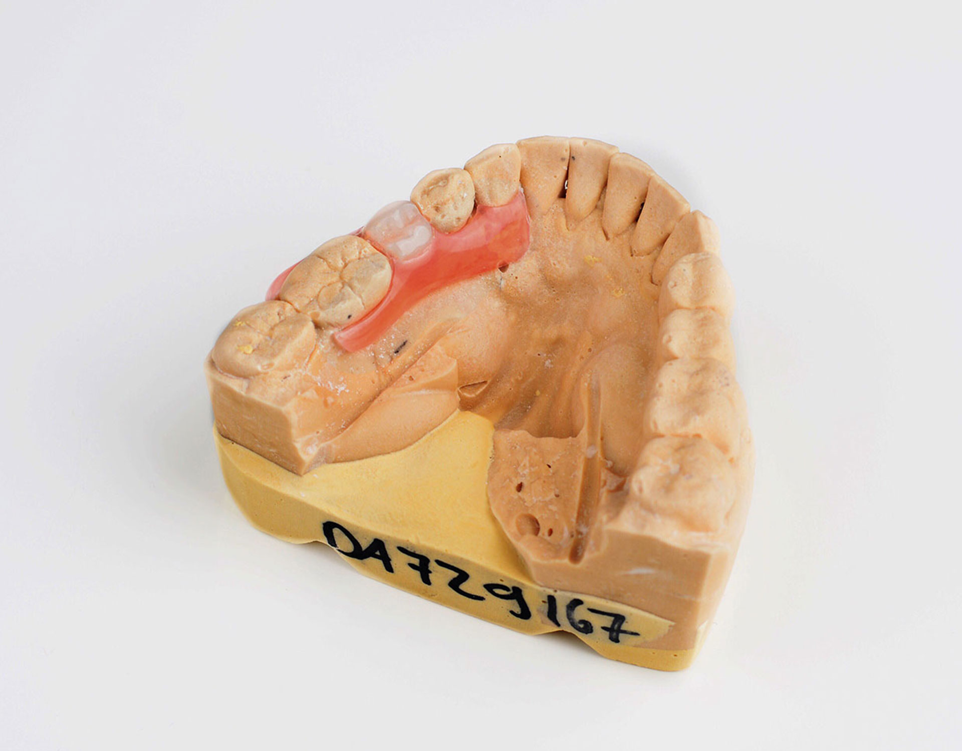 Order Nesbit Flexible Partial Denture Dental Lab Direct