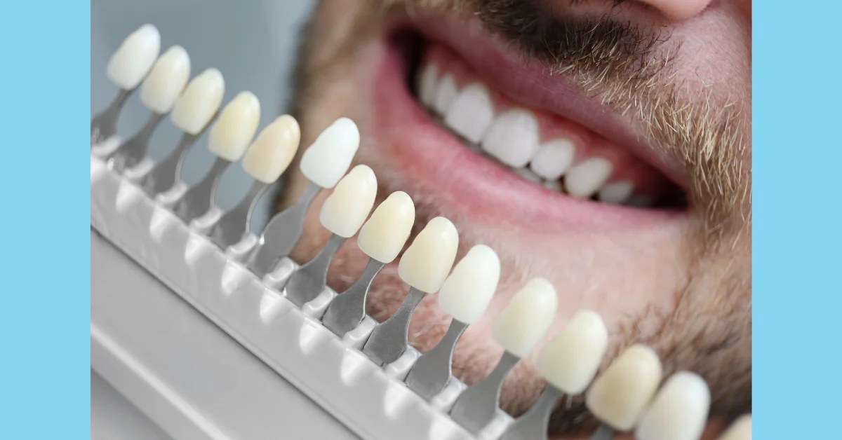 Shaving Teeth for Veneers? Dental Made Easy NYC & LI Smile Design