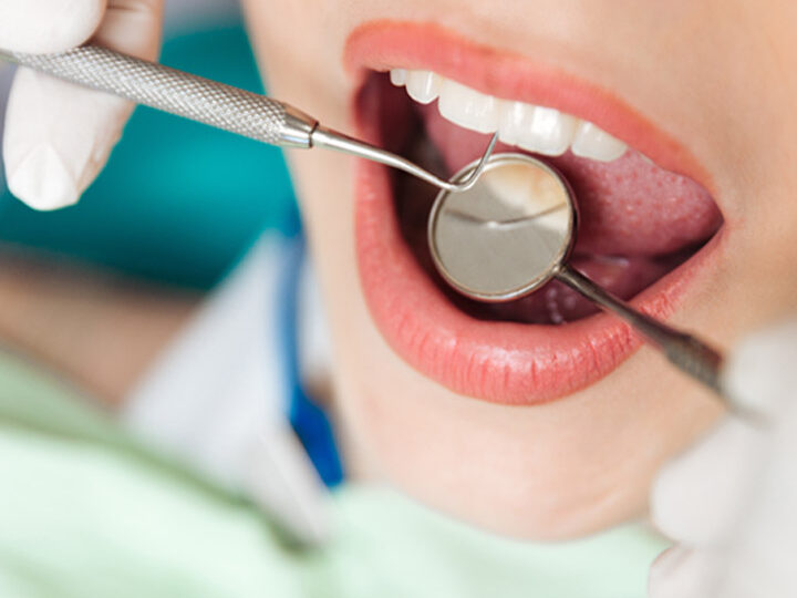 Descubre cuánto cuesta un empaste dental en España precios y consejos
