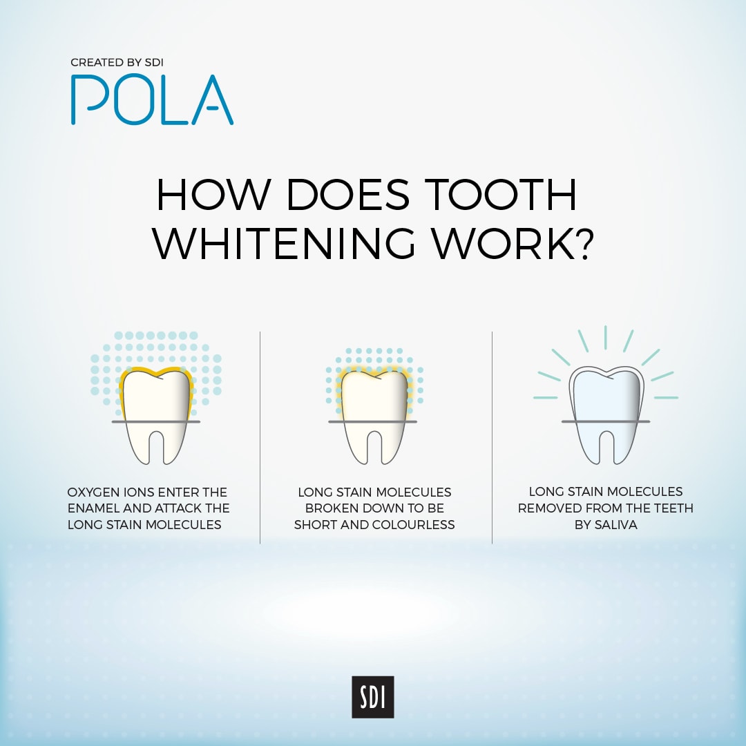 Teeth Whitening Dental on Martyn