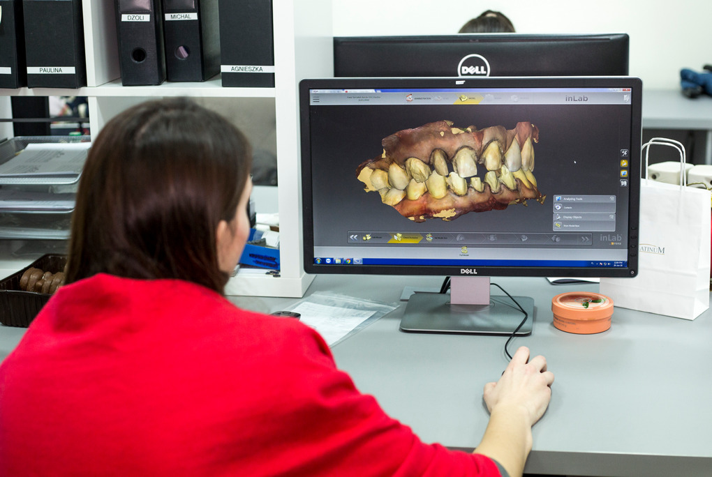 CAD/CAM w stomatologii odkryj tajniki cyfrowego projektowania