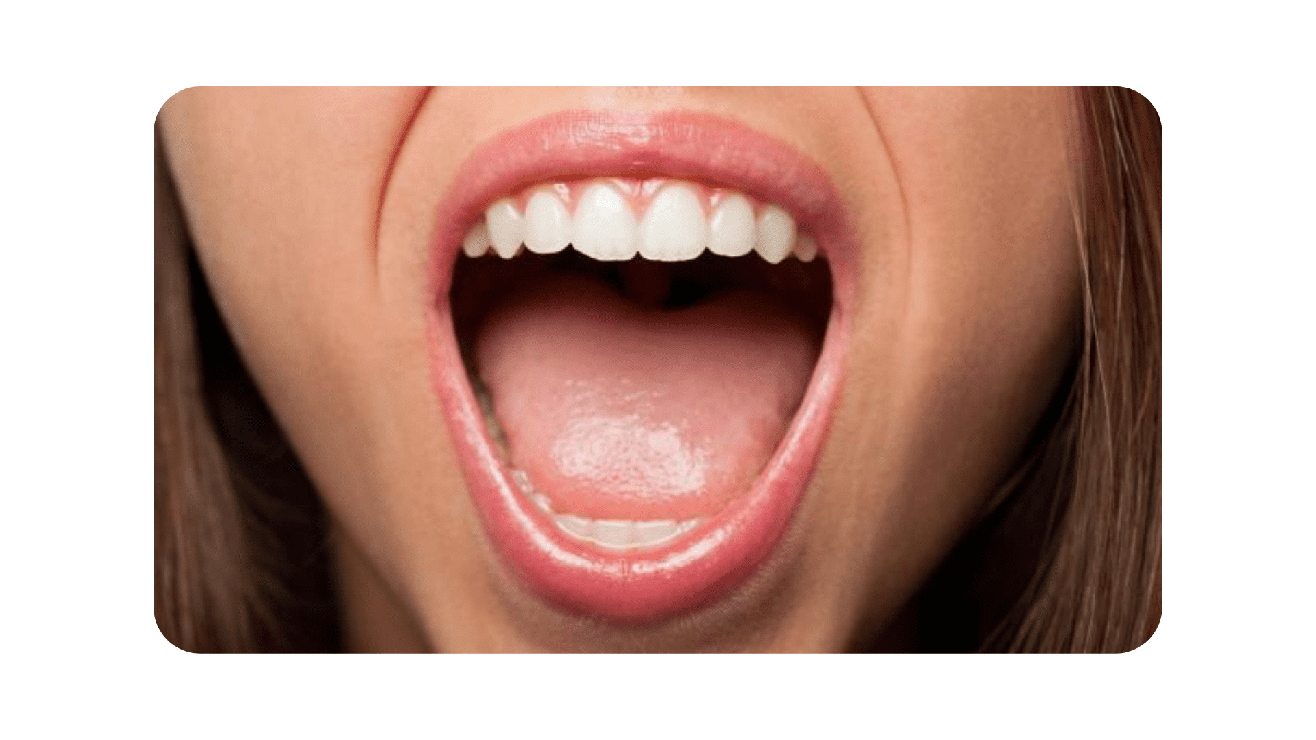 Dry Mouth Problems And Solutions Summerlin Dental Solutions