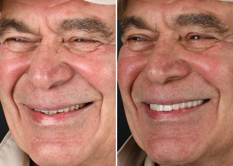 Before & After Dentalzone