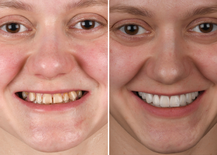 Before & After Dentalzone