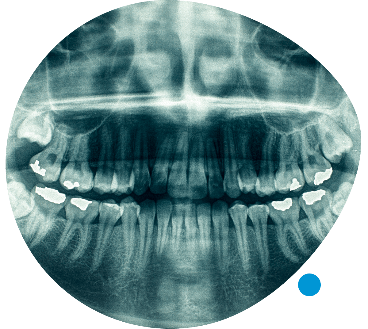 Radiología Dental Dentametrics