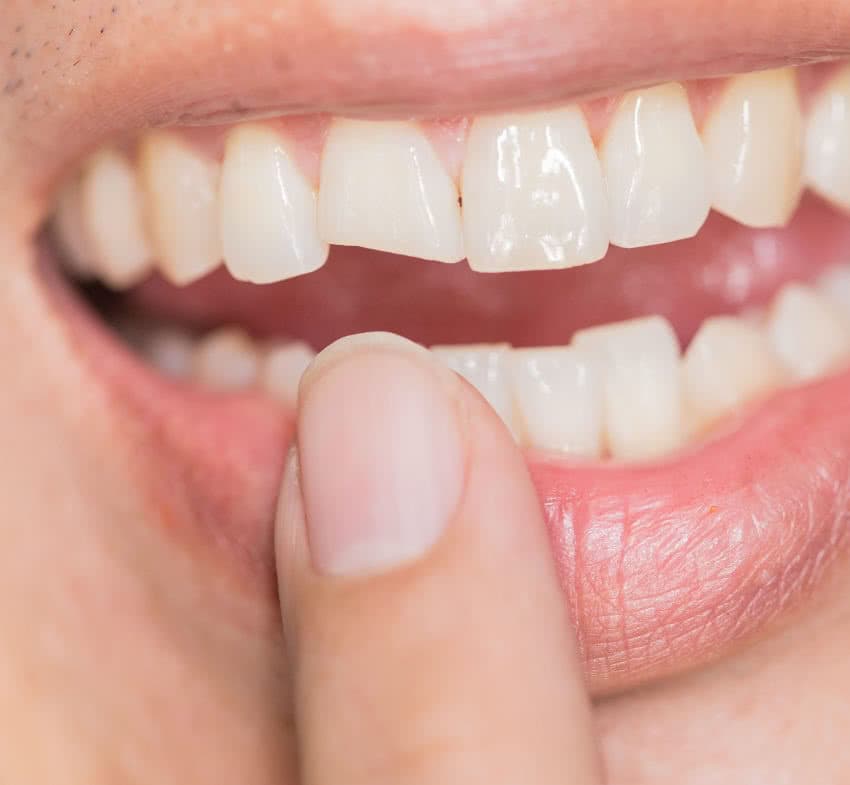 Dental Centre In Turkey DentaTur The Best Treatment Prices