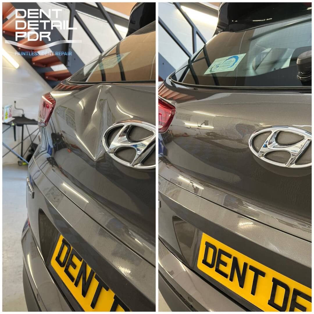 Hyundai Dent Repair Dent Removal Dent Detail PDR