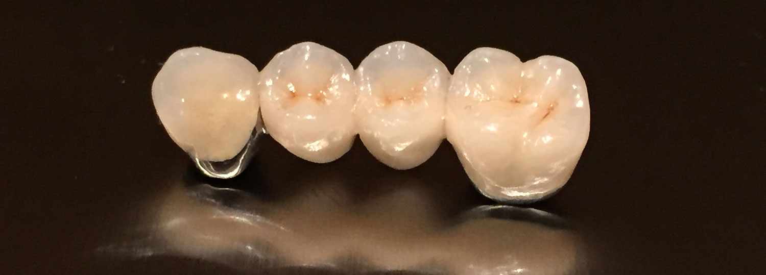 Home Dentech Dental Ceramics