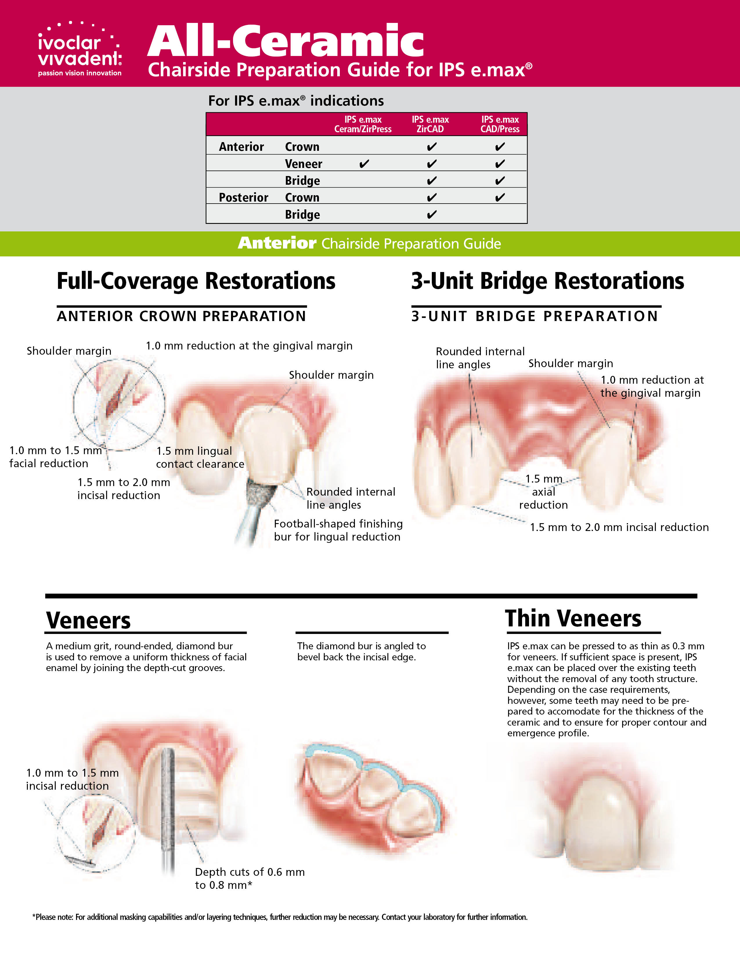 IPS eMAX CAD DenteLAB Laboratorio de Protese Dentaria