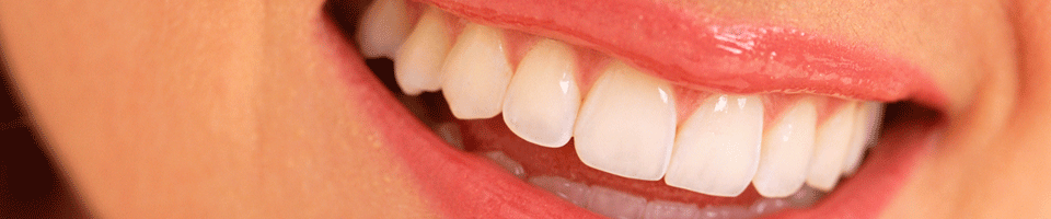 clovis orthodontics Clovis Dentist Dr. Lovik Mirzaeian Serving