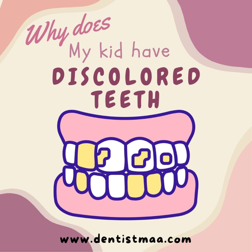 Why does my kid have discolored teeth? DentistMaa