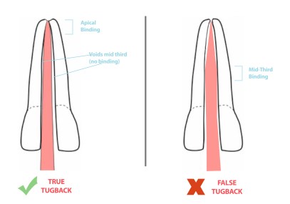 False vs true tug-back