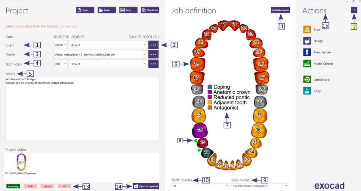 exocad Advanced Lab Bundle