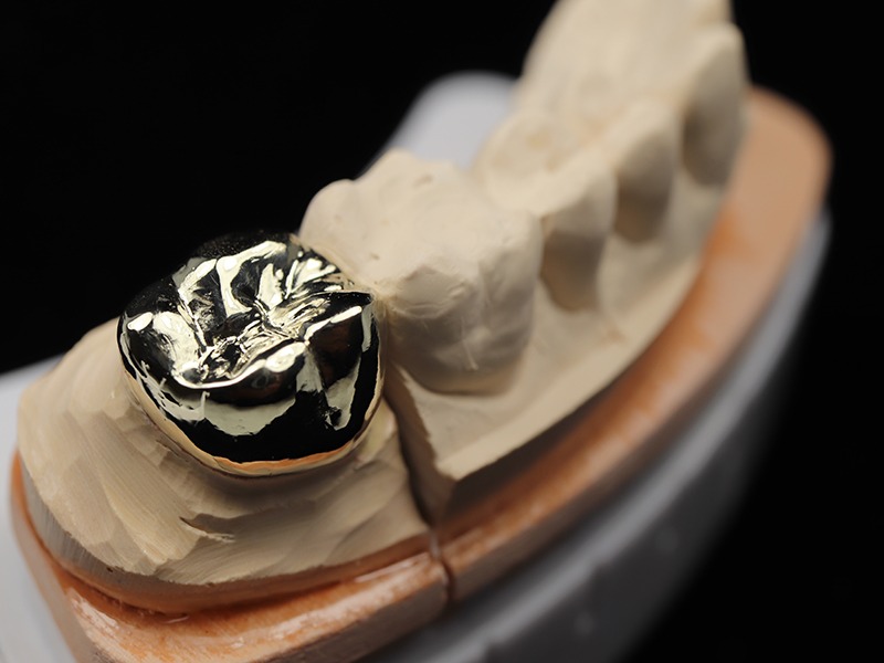 Dental Lab Case Photos Dentopia Dental Lab