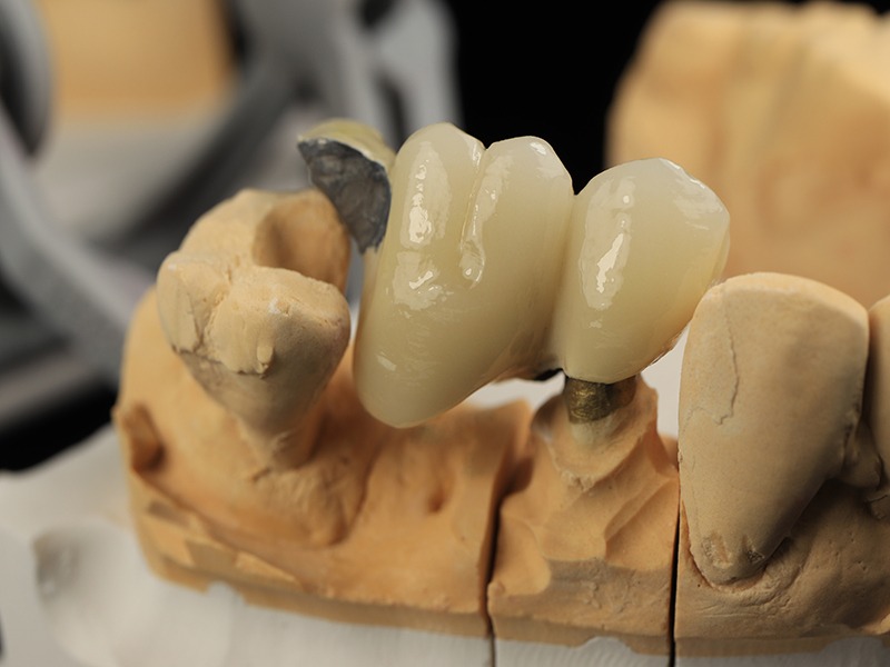 Dental Lab Case Photos Dentopia Dental Lab