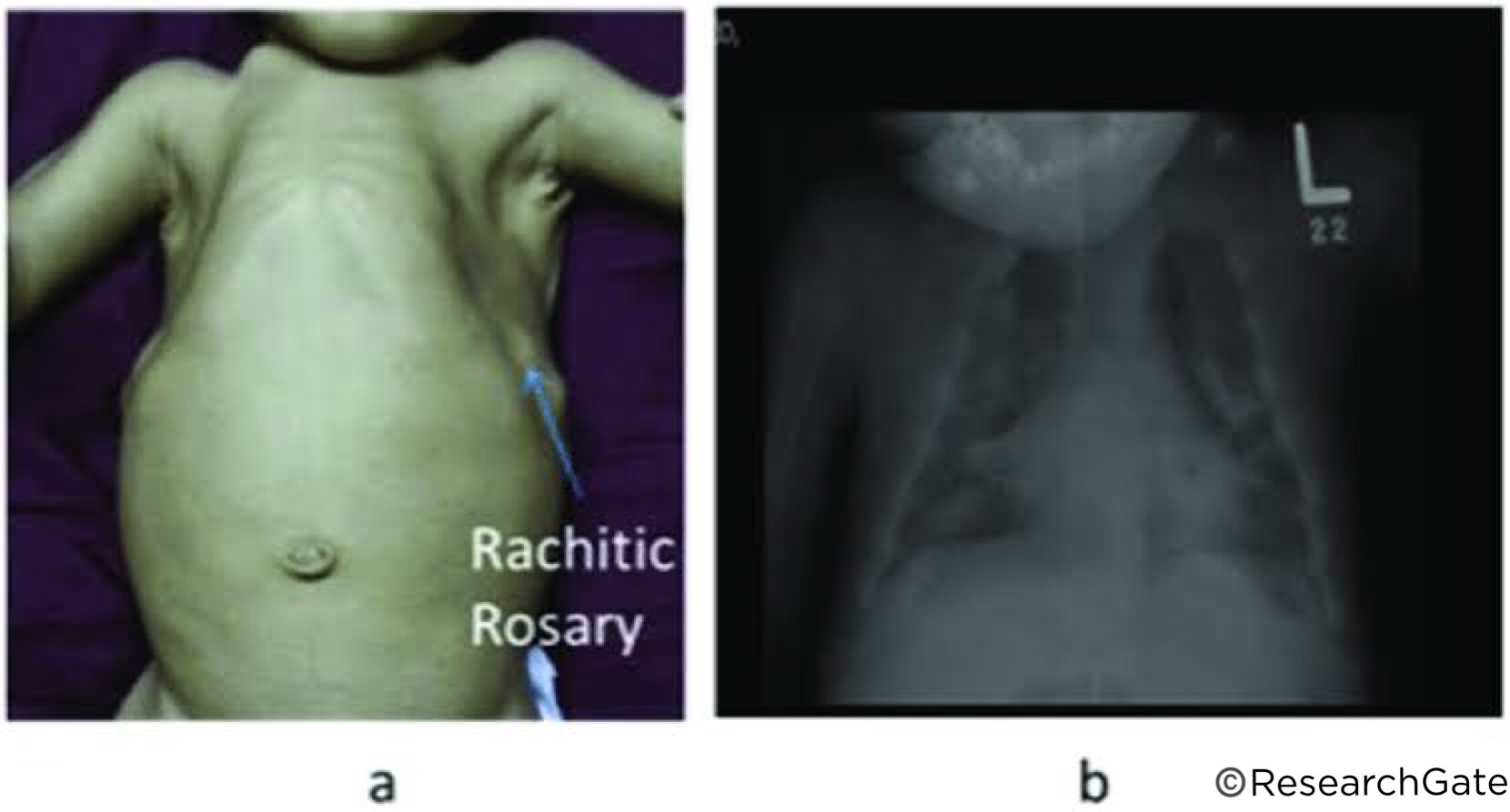 RESPIRATORY SYSTEM Dentowesome
