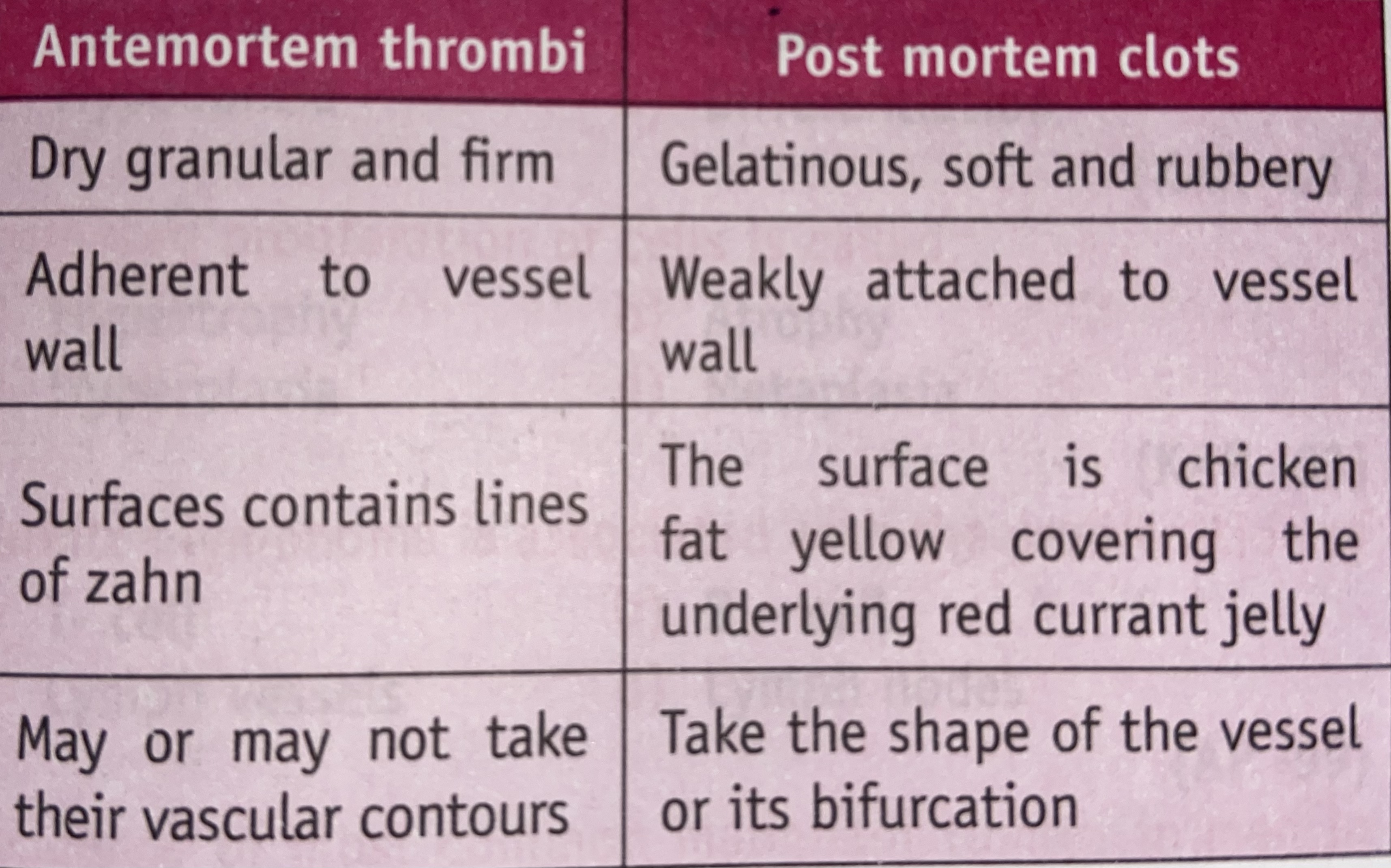 DIFFERENCE BETWEEN ANTEMORTEM THROMBI AND POST MORTEM CLOTS Dentowesome