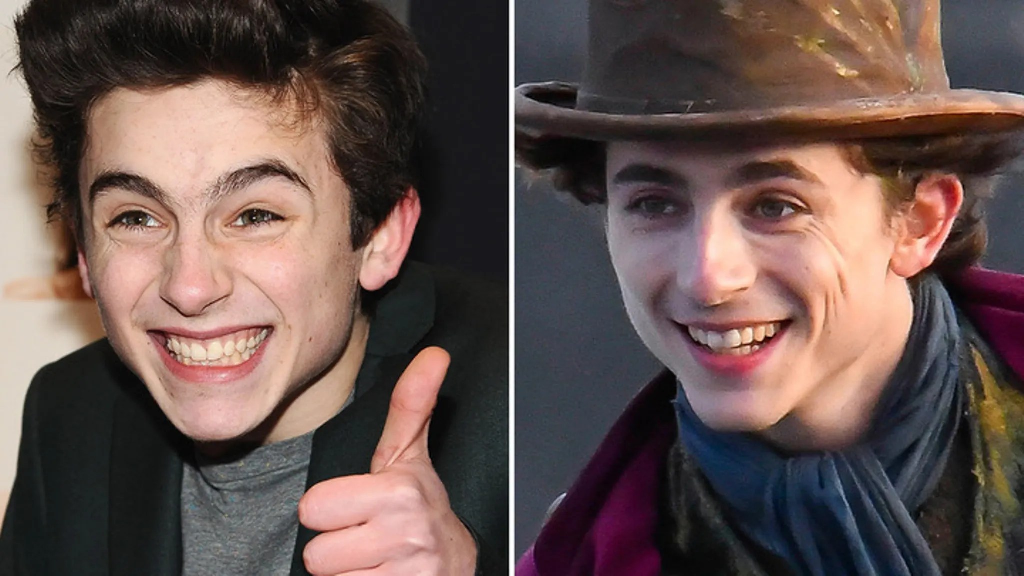 Timothe Chalamet Zahntransformation Vorhernachheranalyse
