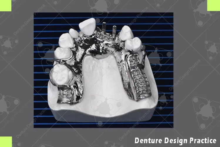CobaltChrome Frames Denture Design Practice