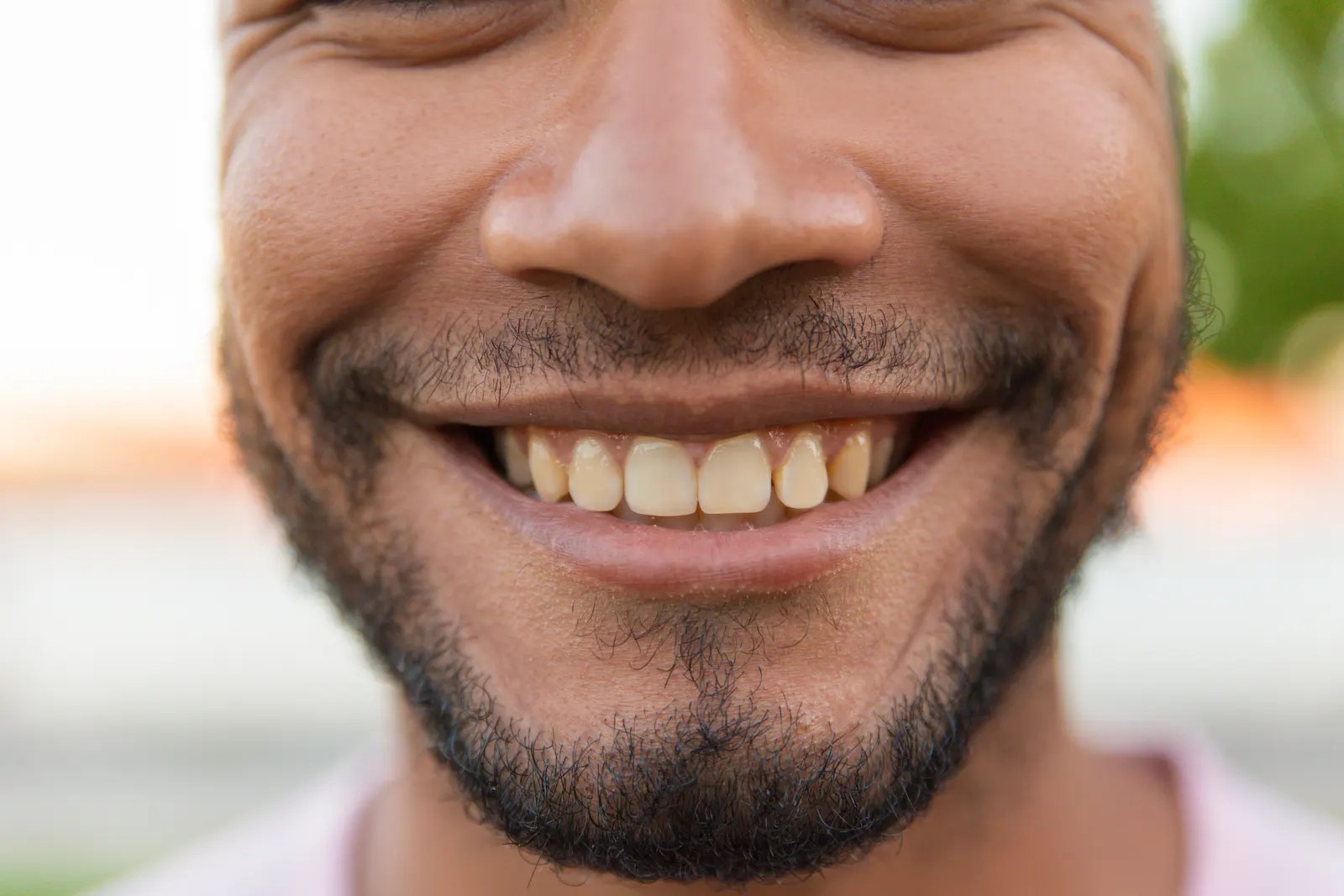 Calcium Deposits on Teeth Causes, Symptoms, and Treatment Dent X