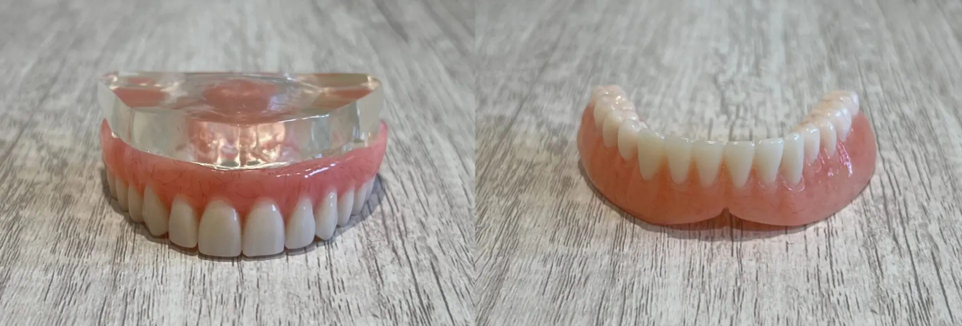 Dentures Denver, CO Denver Dentures