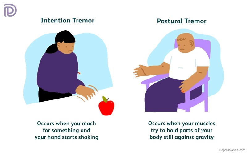 Tremor Types, Categories, Diagnoses and Treatment