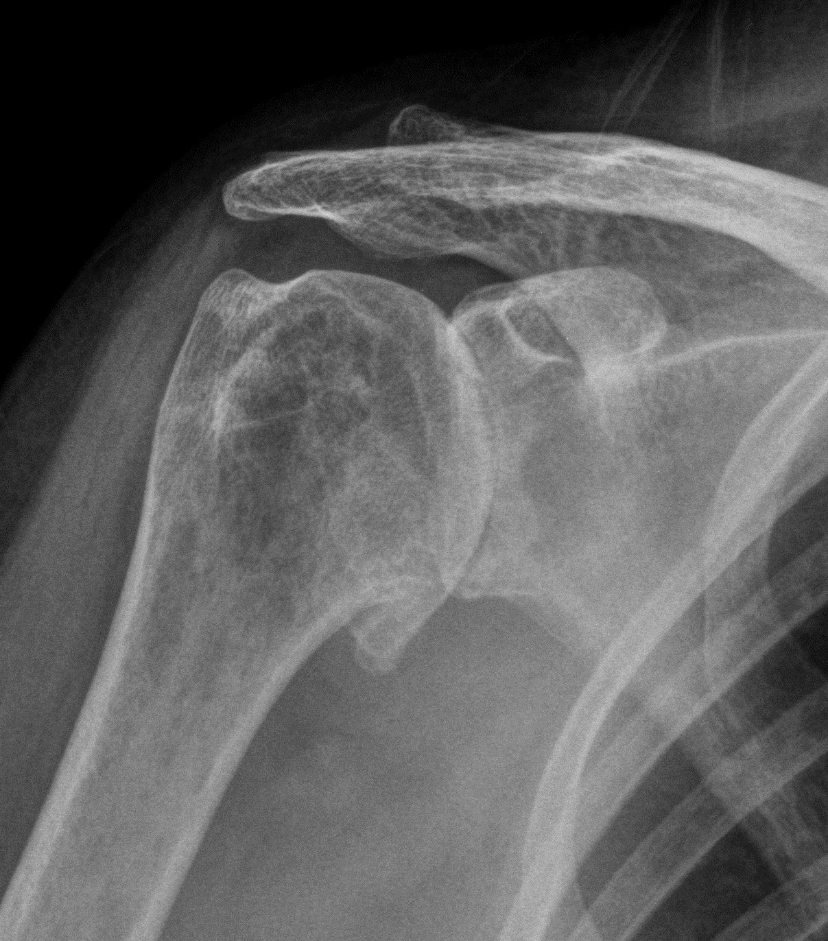 COMMON CONDITIONS Derby Shoulder Unit