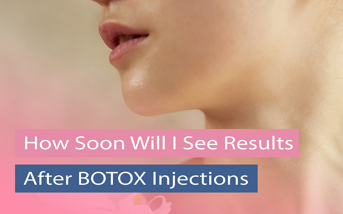 How Long Does It Take To See Results of Botox? And When Does Botox Start To Work Derma Solution