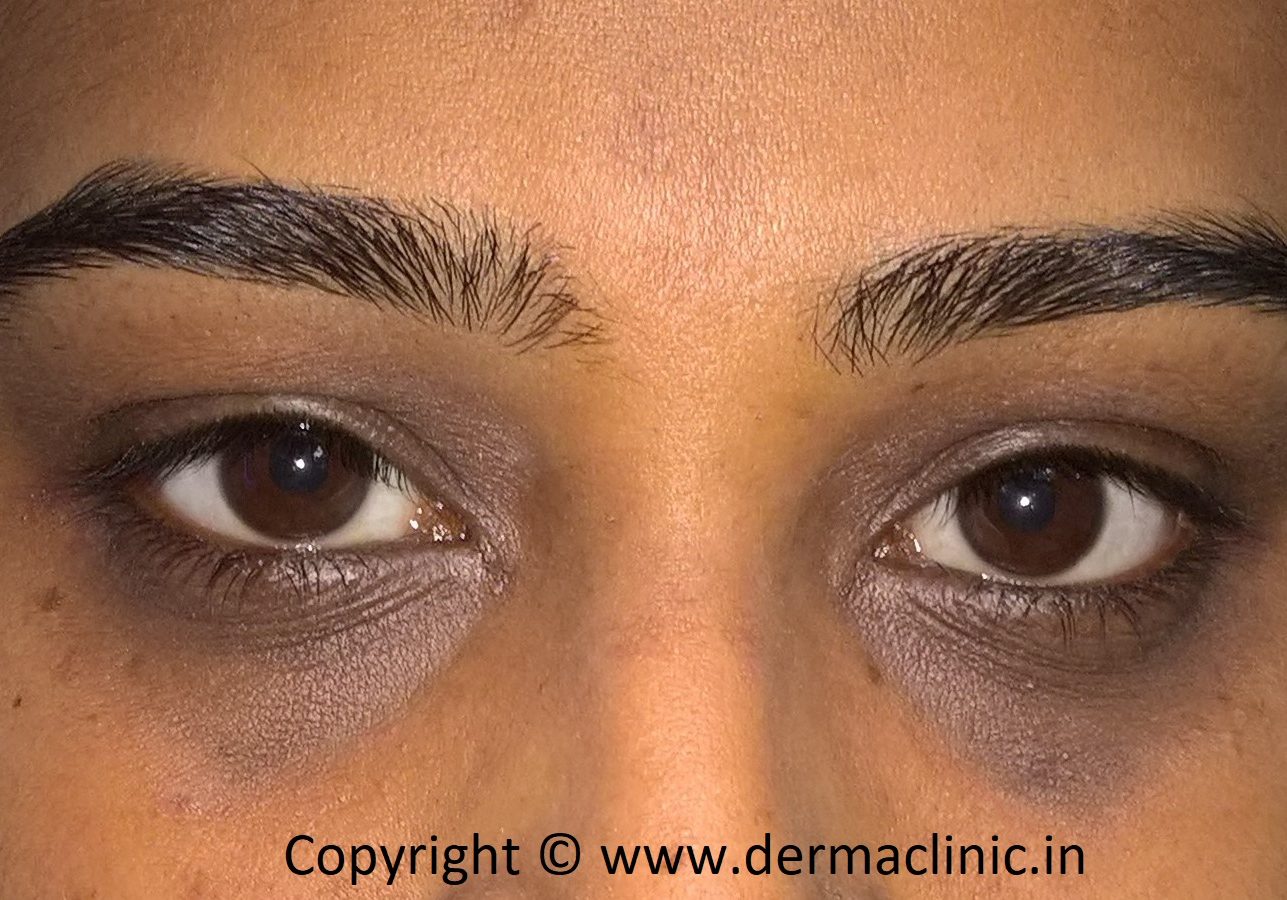 Aesthetics and Cosmetic Surgery for Darker Skin Types, , Good.