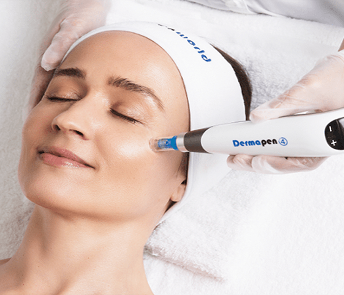 Discover Rejuvenating Dermapen 4 Treatment in Delhi Expert Skincare