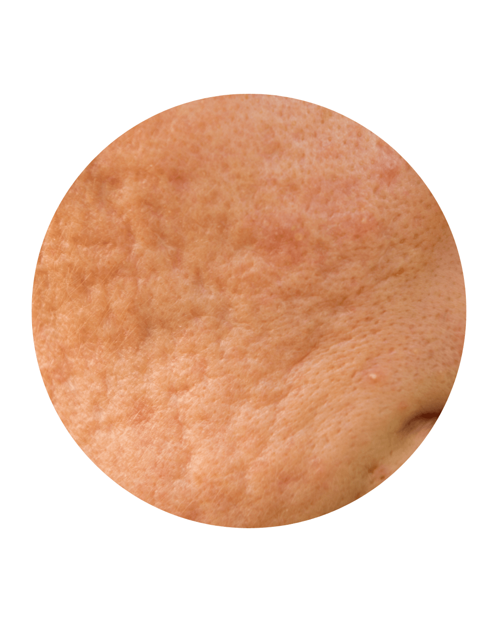 Skin Health MOT Mole Check & Removal London Harley Street