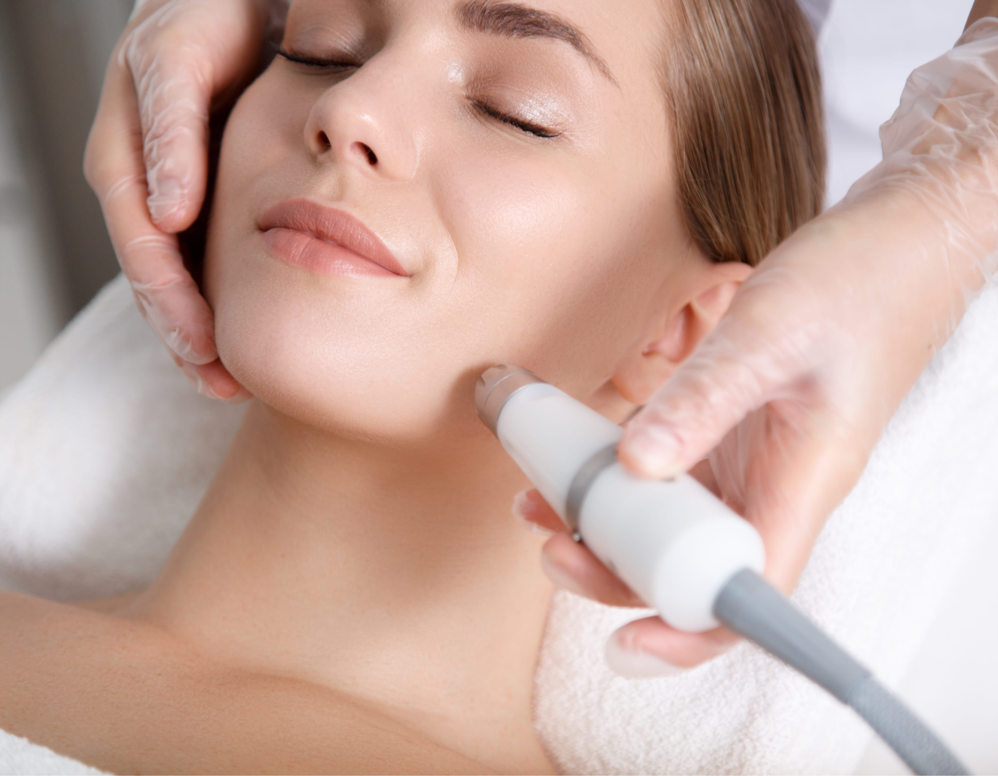 Microdermabrasion Sacramento Center for Dermatology
