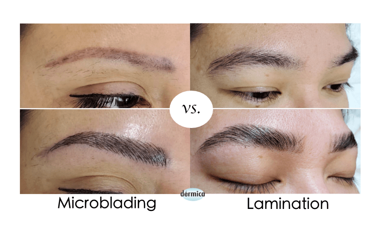 Microblading vs Lamination What is the difference?