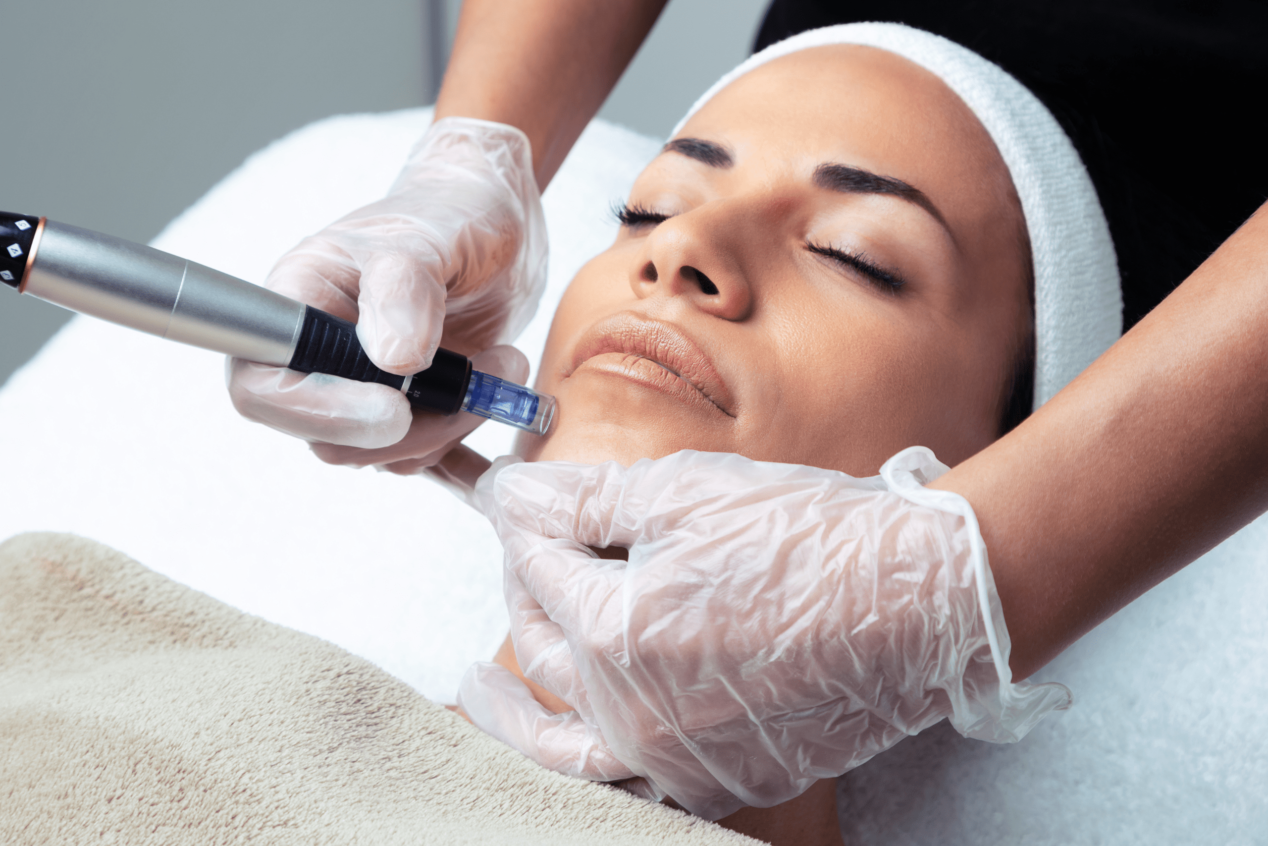 Understanding Microneedling A Guide to Achieving Flawless Skin