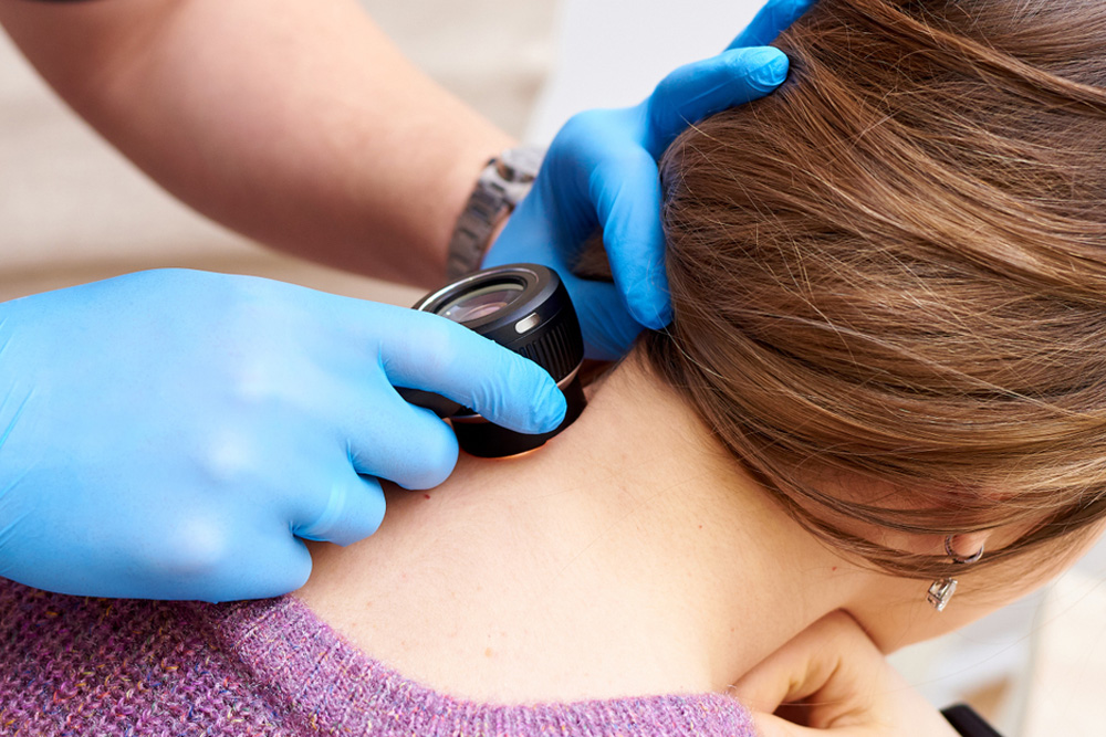 Skin Cancer Screening Services Dermatology of Cape Cod Dermatology