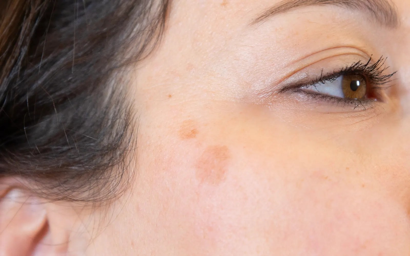 Introduce 151+ imagen taches orange sur la peau fr.thptnganamst.edu.vn