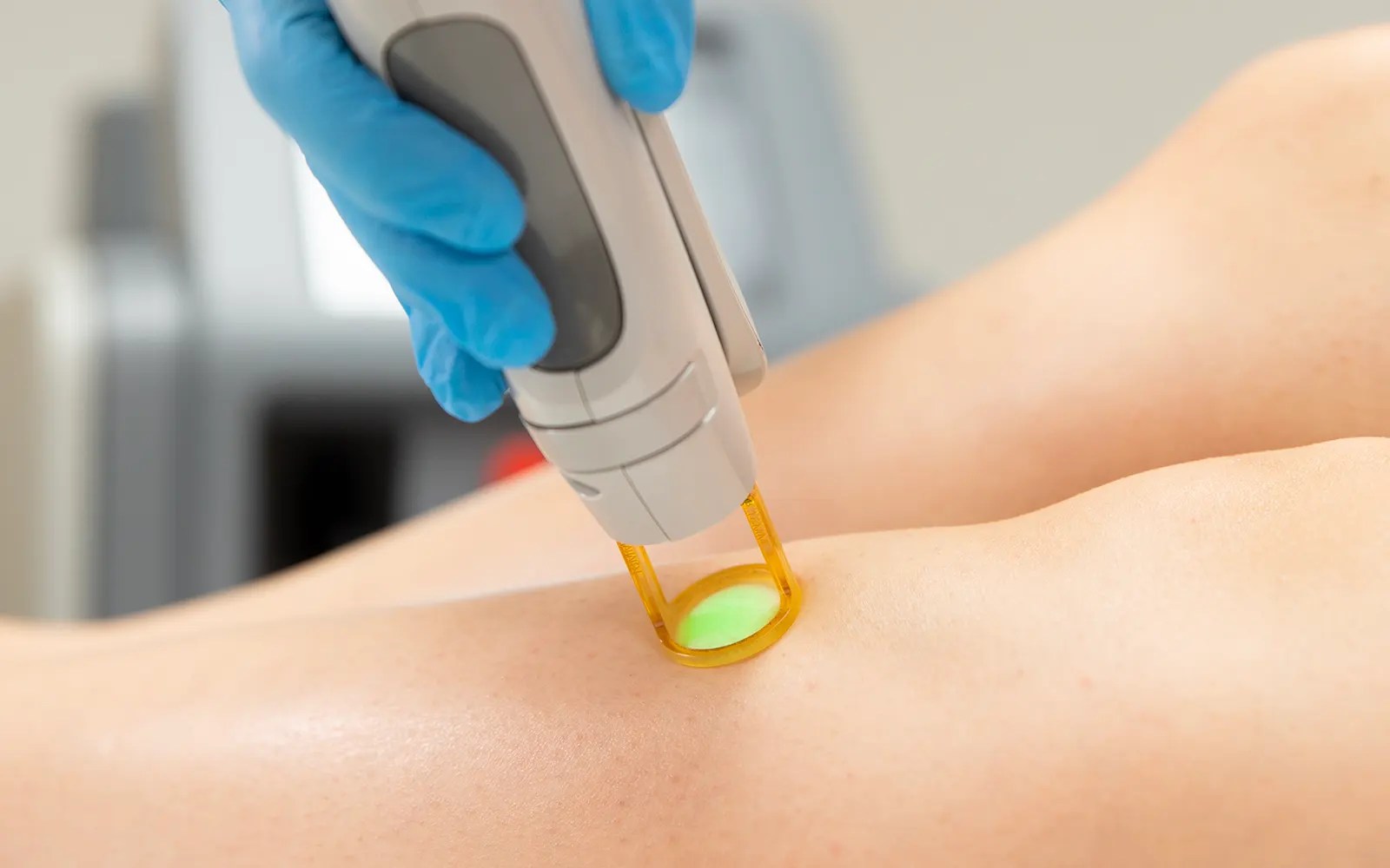 Épilation définitive au laser à Paris DermoMedicalCenter