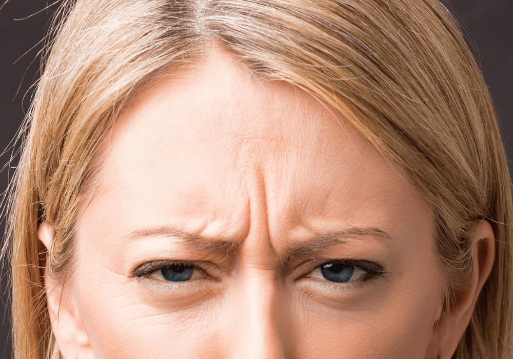 Botox for 11 Lines Between the Eyes Integrated Dermatology of Reston