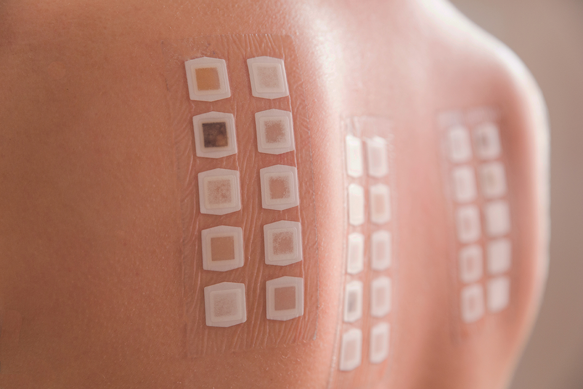 Allergy Patch Testing Dermatology Specialists of Spokane
