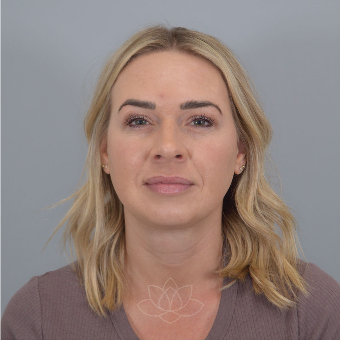 Desert Bloom Plastic Surgery